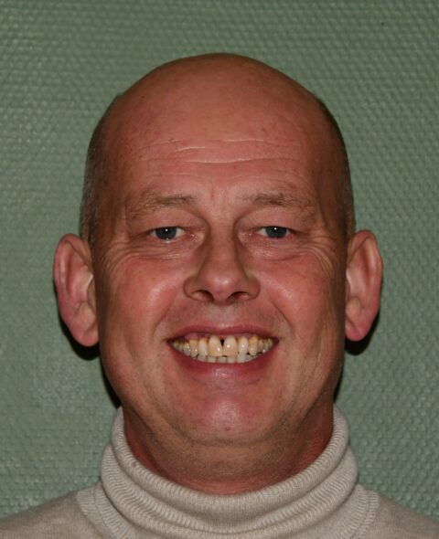 Johan Boonstra